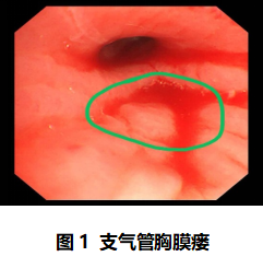 17610161673093.png